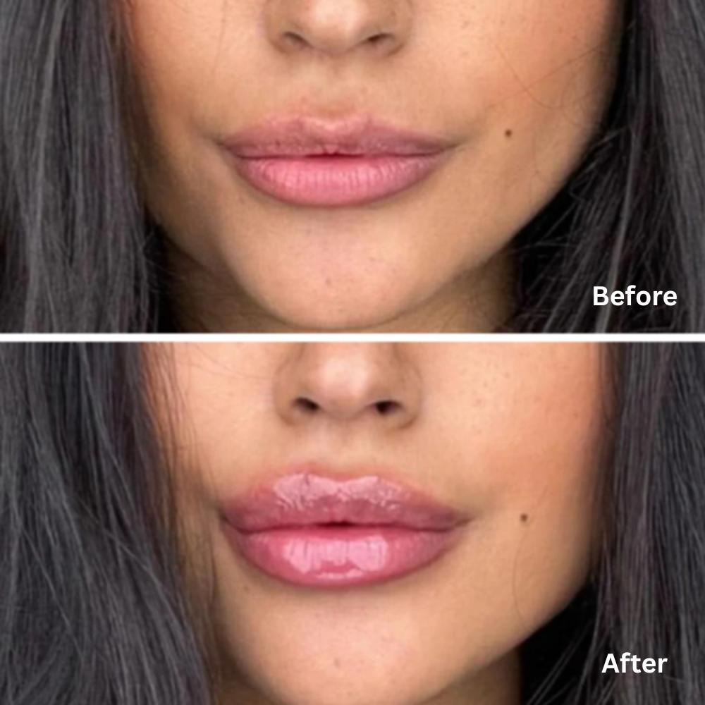 Extreme Lip Plumper